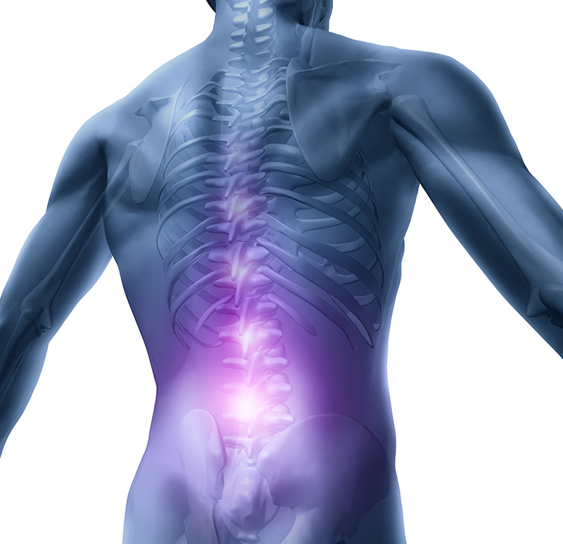 A Complete Overview of Chronic Low Back Pain