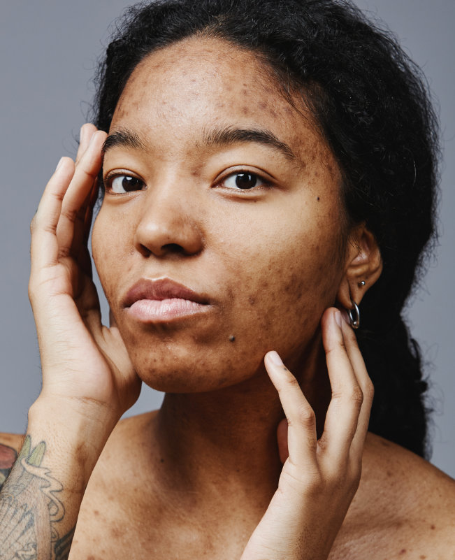 Painful breakouts and swelling